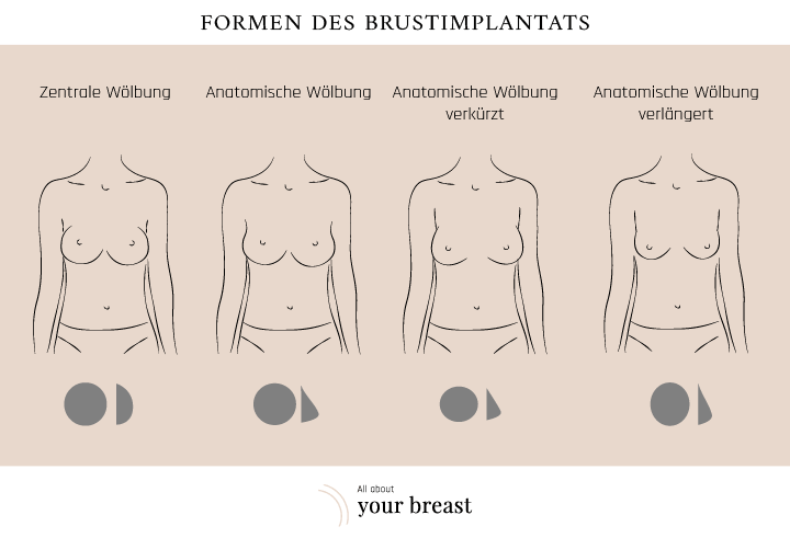 Formen Brustimplantate 