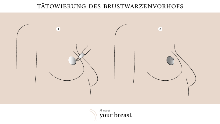 Tätowierung des Brustwarzenvorhofs 