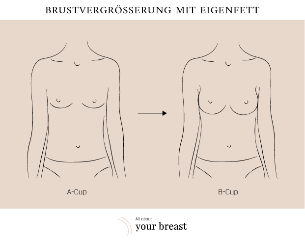 Im vergleich brustgrößen Körbchengröße B