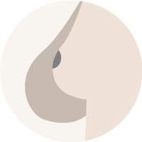 Asymmetrische Brüste (Anisomastie) 